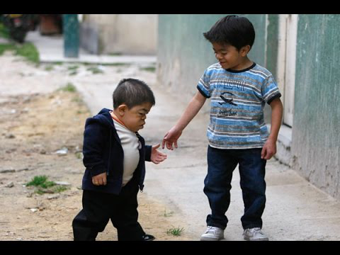 Top 10 Shortest People in the World