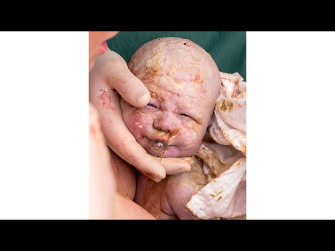 International Day of the Midwife 2014