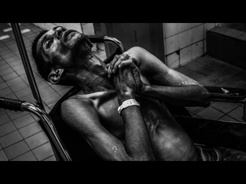 How to Survive a Malaria Infection