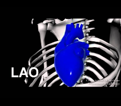 Radiology Basics - How to read a chest x ray ?