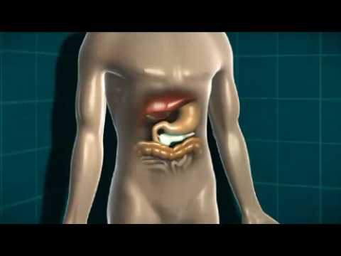Animation about diabetes and the body.