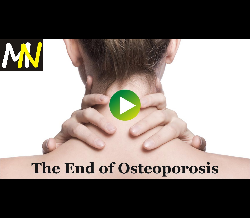 The End of Osteoporosis